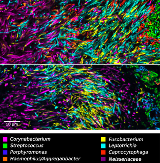 Illustration for article titled There Are Some Seriously Psychedelic Bacteria Living on Your Teeth